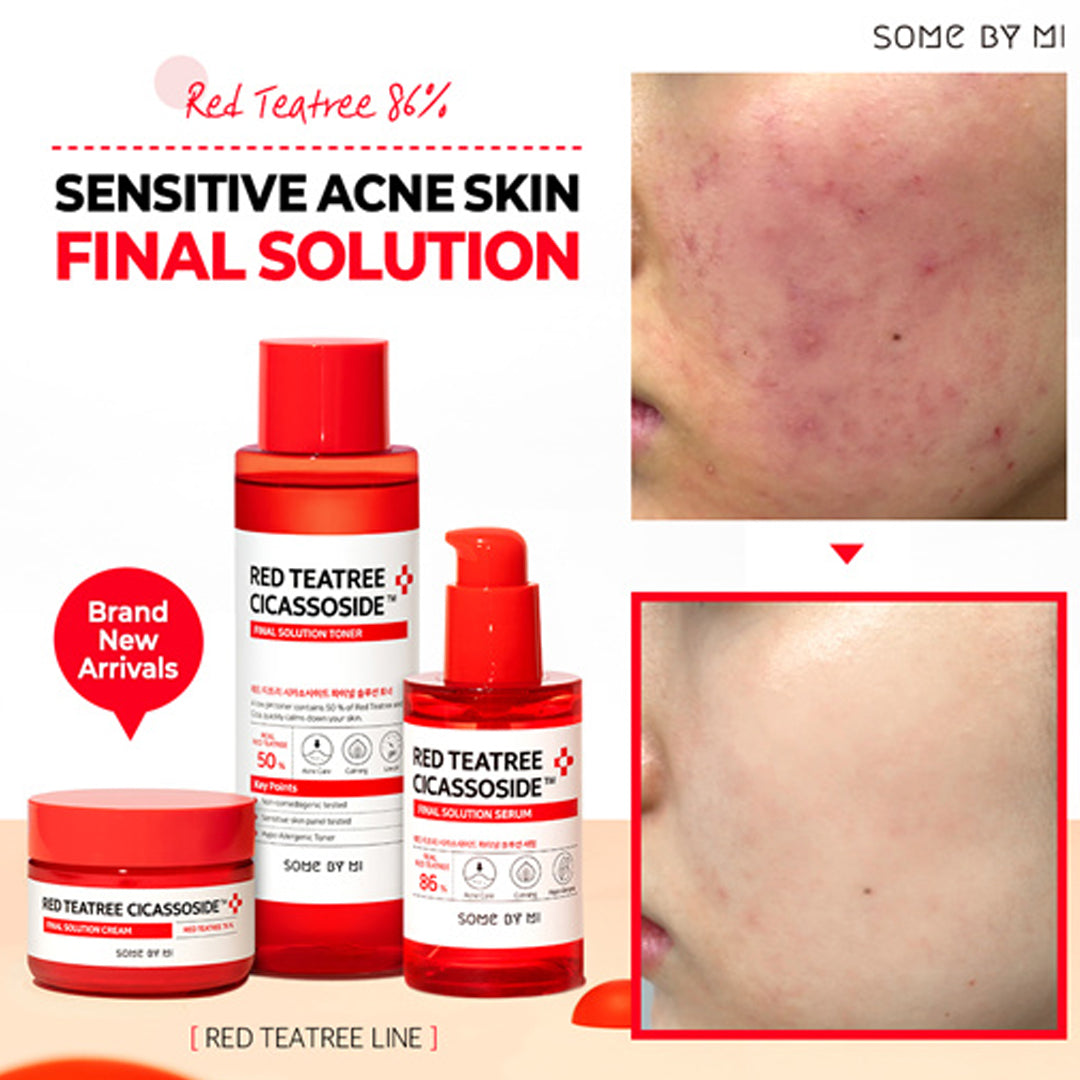 Some by Mi. Red Teatree Cicassoside Derma Solution Toner 150ml